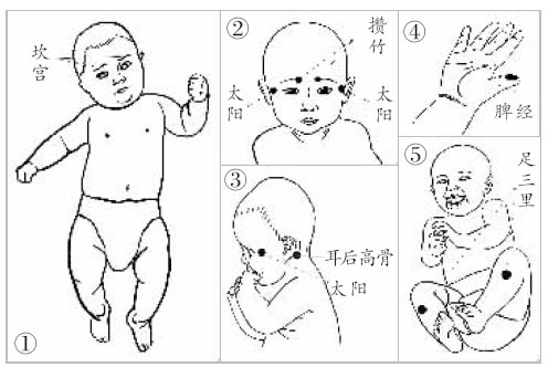 四大手法防治宝宝感冒