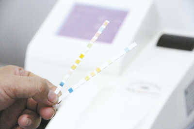 第一步:尿液干化学检验仪