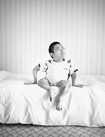 被遗忘的"孤儿病"(聚焦·关注罕见病(上.