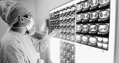 图为北京儿童医院胸外科主任曾骐手术前看片子.